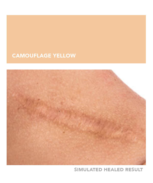 Camouflage Yellow - Chanco Beauty Canada by Micro-Pigmentation Centre