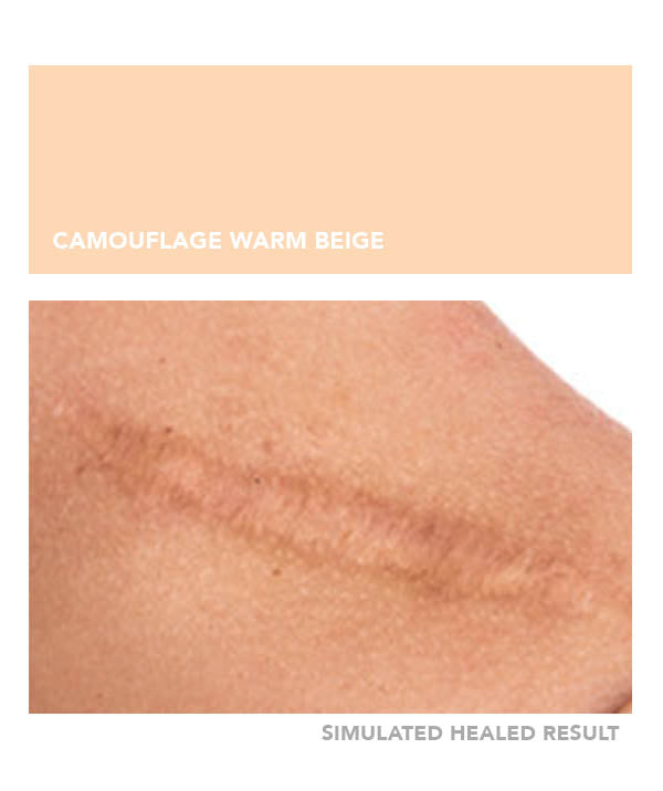 Camouflage Warm Beige - Chanco Beauty Canada by Micro-Pigmentation Centre