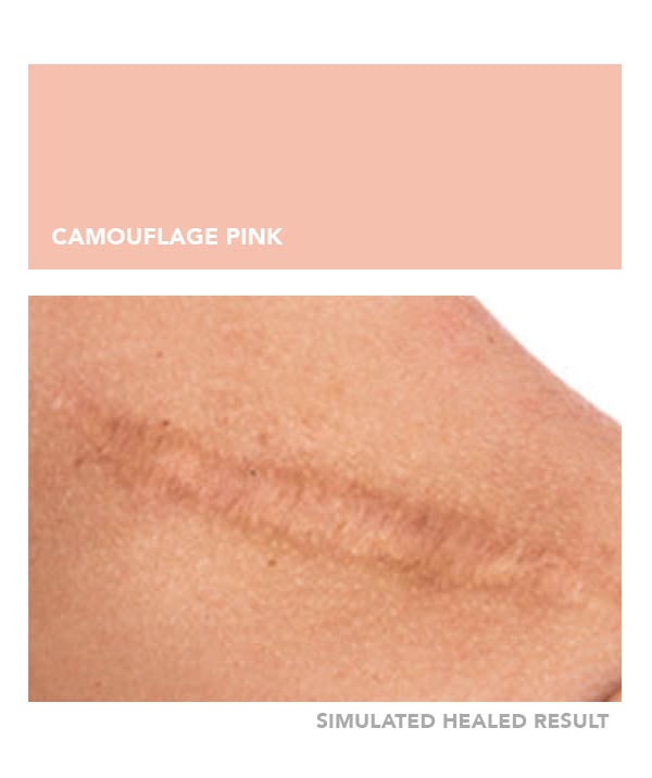 Camouflage Pink - Chanco Beauty Canada by Micro-Pigmentation Centre