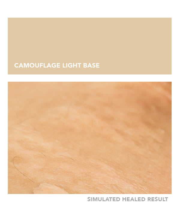 Camouflage Light Base - Chanco Beauty Canada by Micro-Pigmentation Centre