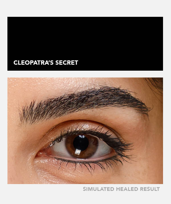 Cleopatra's Secret - Chanco Beauty Canada by Micro-Pigmentation Centre