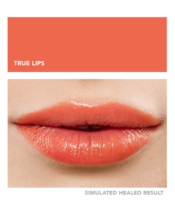 True Lips - Chanco Beauty Canada by Micro-Pigmentation Centre